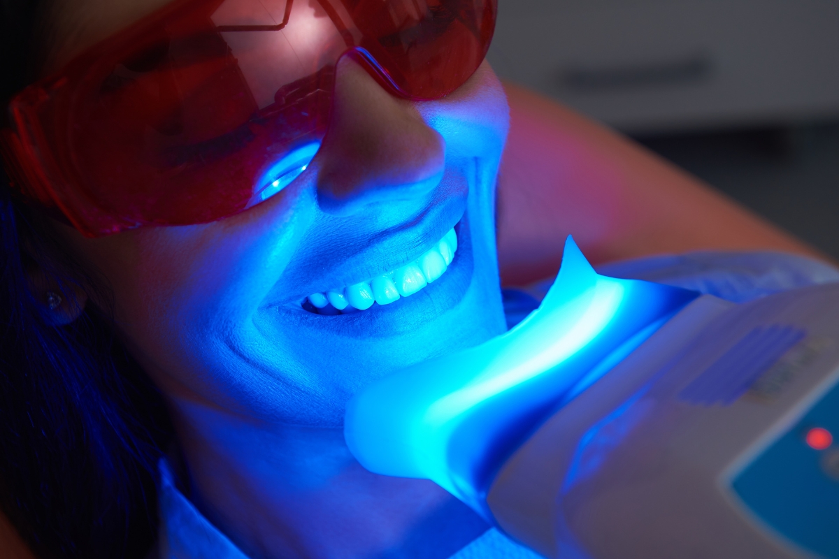 teeth-whitening-in-Sterling-Heights