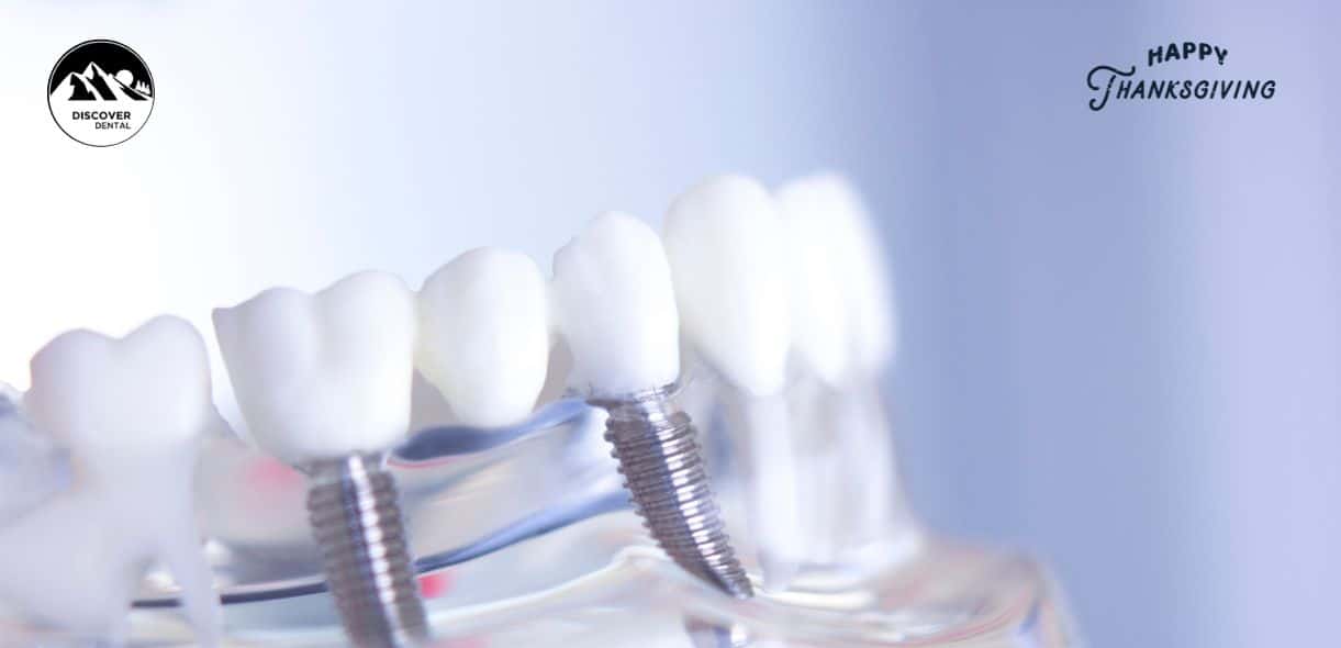 Dental Implants - Discover Dental Rocklin