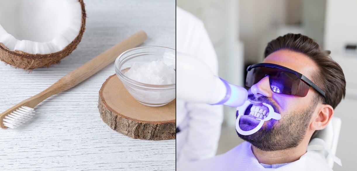 Professional vs DIY Teeth Whitening: Which Method Is Right for You?