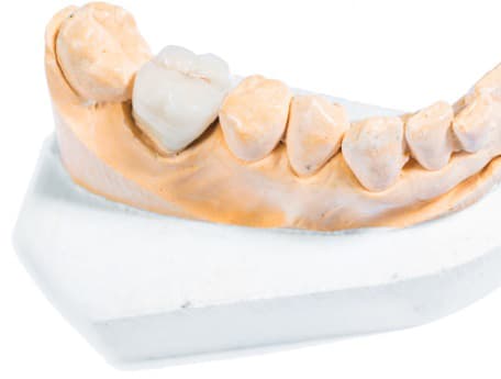 Temporary Crown Post-Op Instructions