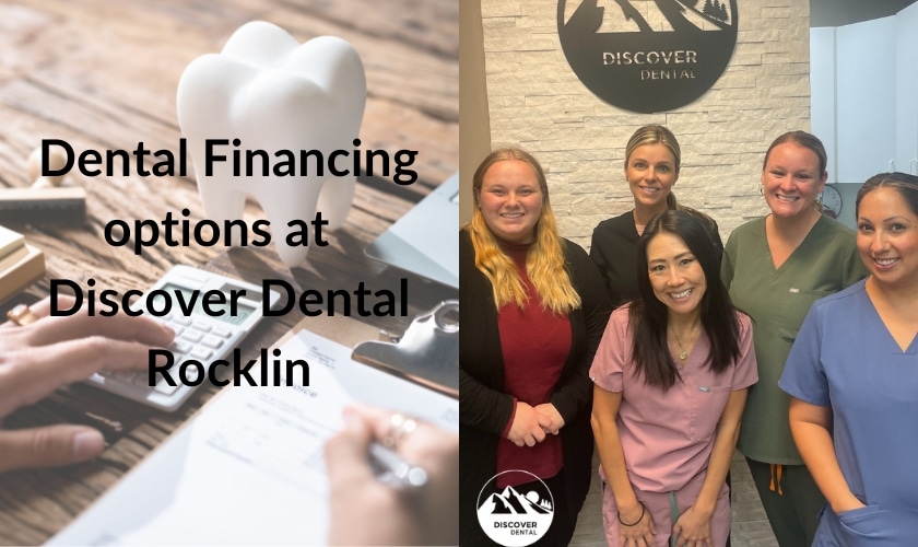 Understanding Dental Financing – What You Need to Know Before Your Next Appointment?