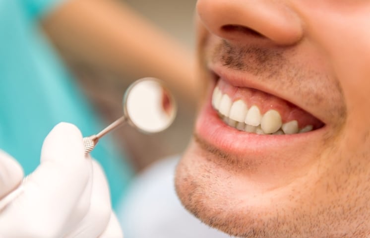What to Expect During Your First Dental Cleaning in Lincoln?