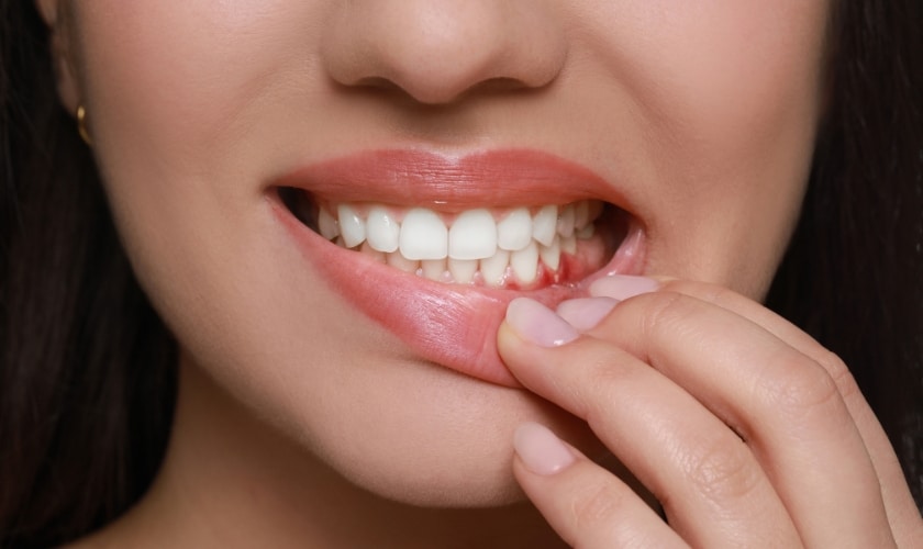 Can You Get Veneers If You Have Gum Disease? What Dentists Say