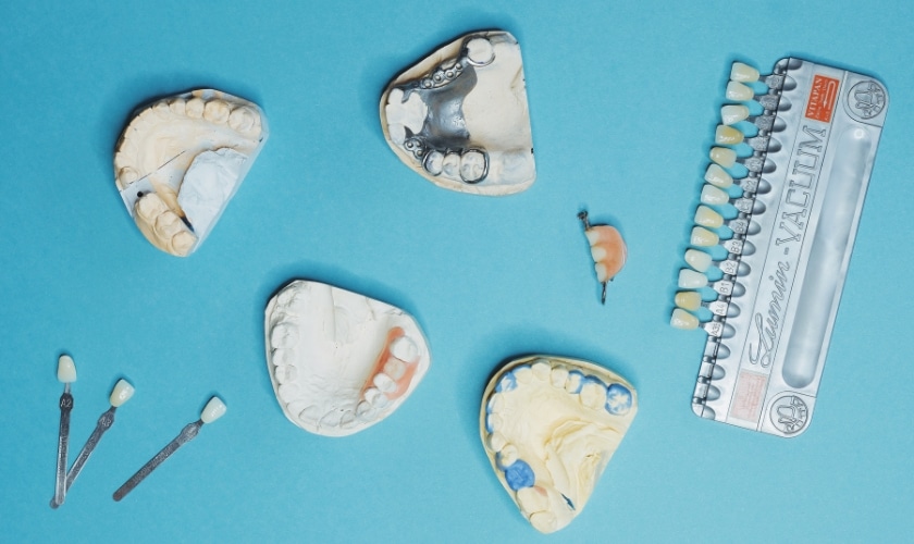 Do Veneers Fix Gaps, Chips, and Stains? Find Out What’s Possible