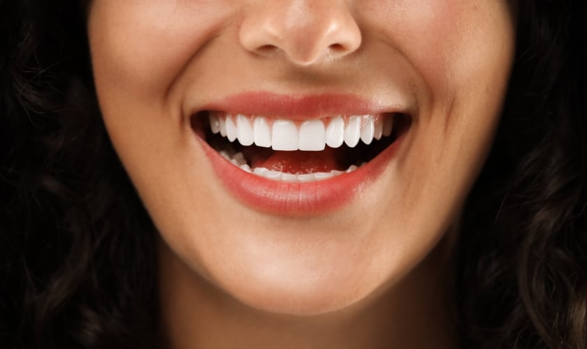 Instant Smile Makeover: How Long Does It Take to Get Veneers?