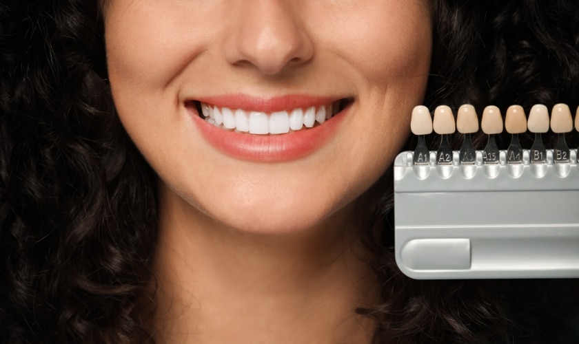How to Take Care of Your Veneers: Advice from Cosmetic Dentists