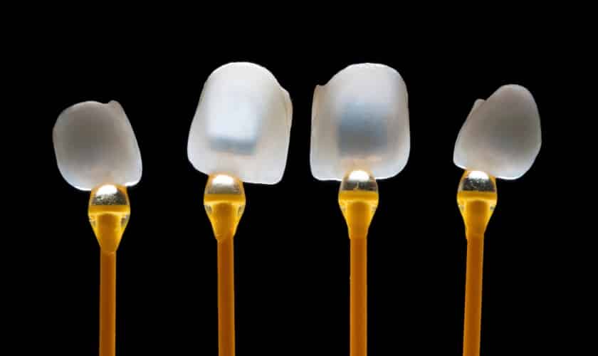 Porcelain vs. Composite Veneers: Which One is Right for You?