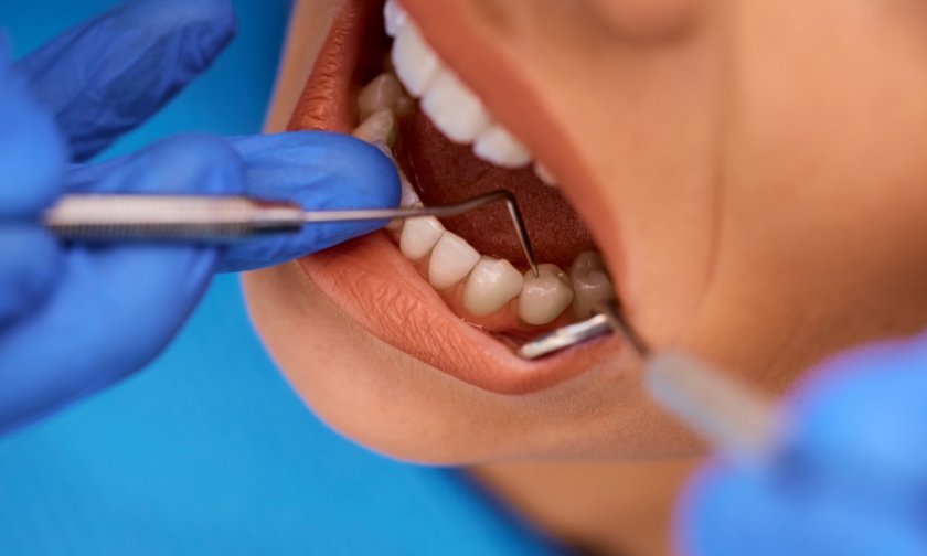 stop gum bleeding with dr pak
