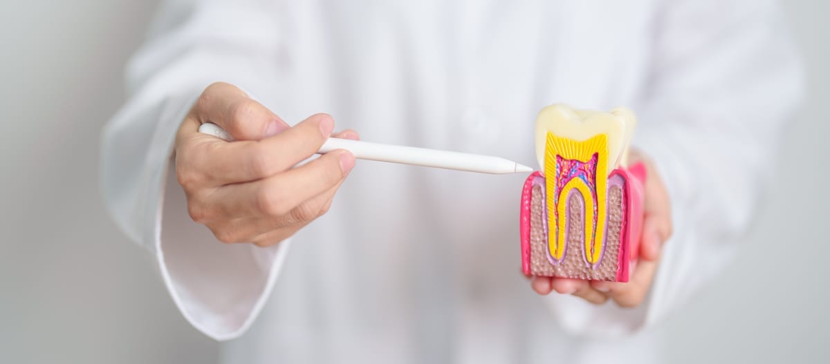 Root Canal Treatment in Airway Heights