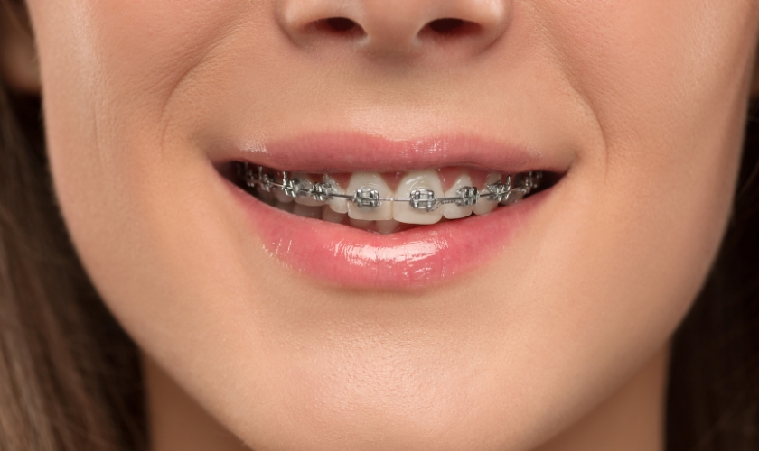 orthodontist in Spokane Valley