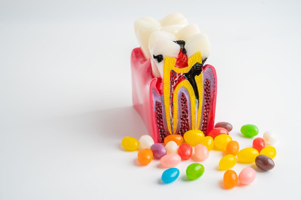 Root Canal Treatment in Hagerstown