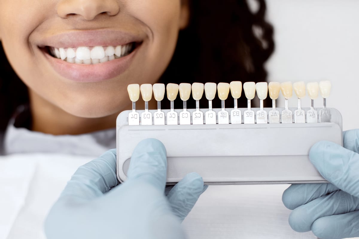 Veneers in Hagerstown