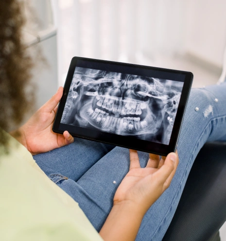 Digital X-Rays