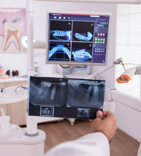 High End Dental Laboratory Support