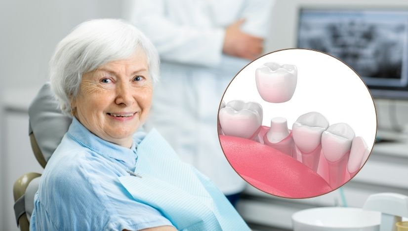 How to Protect Your Dental Crown with Everyday Habits