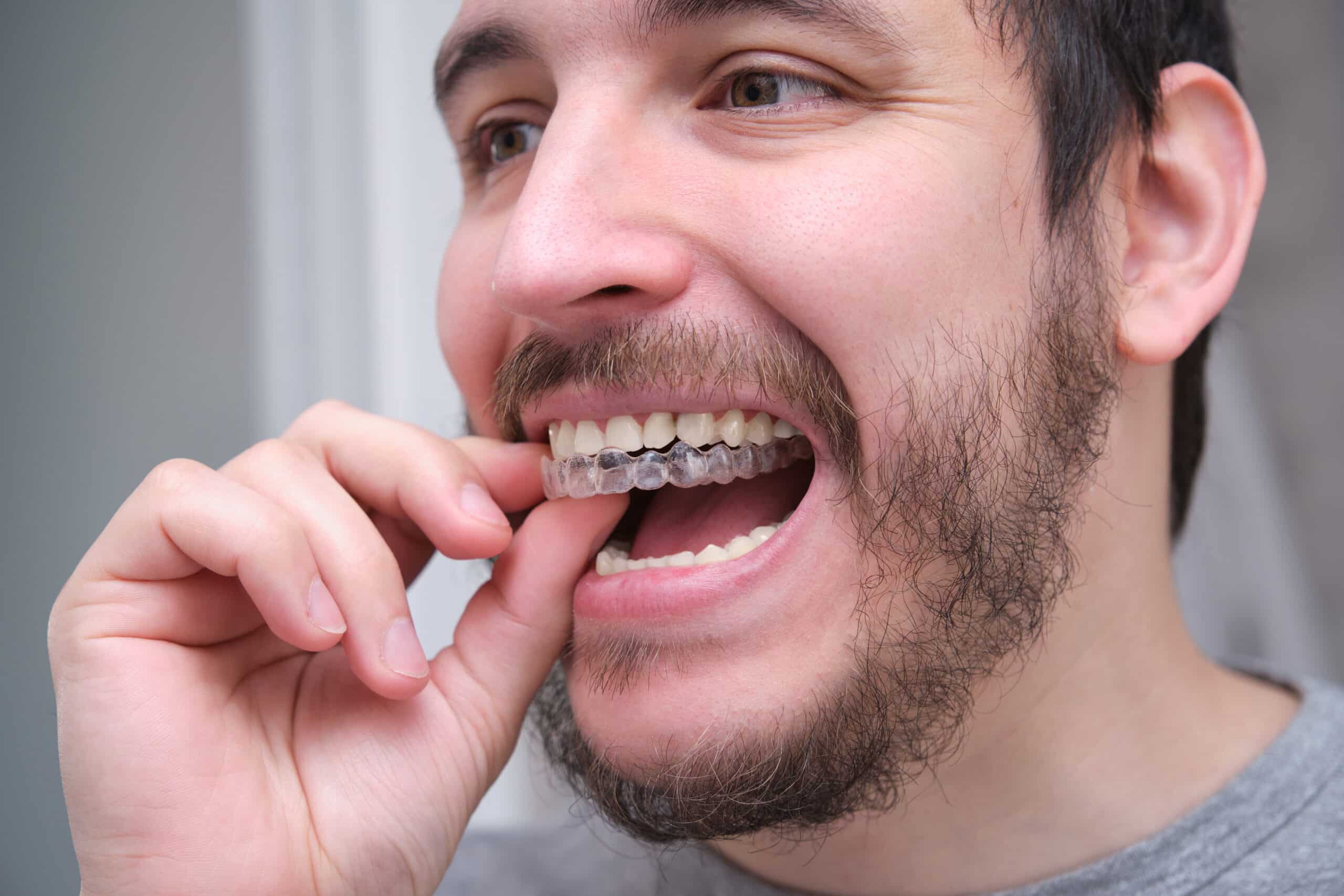 Care for Your Teeth and Aligners