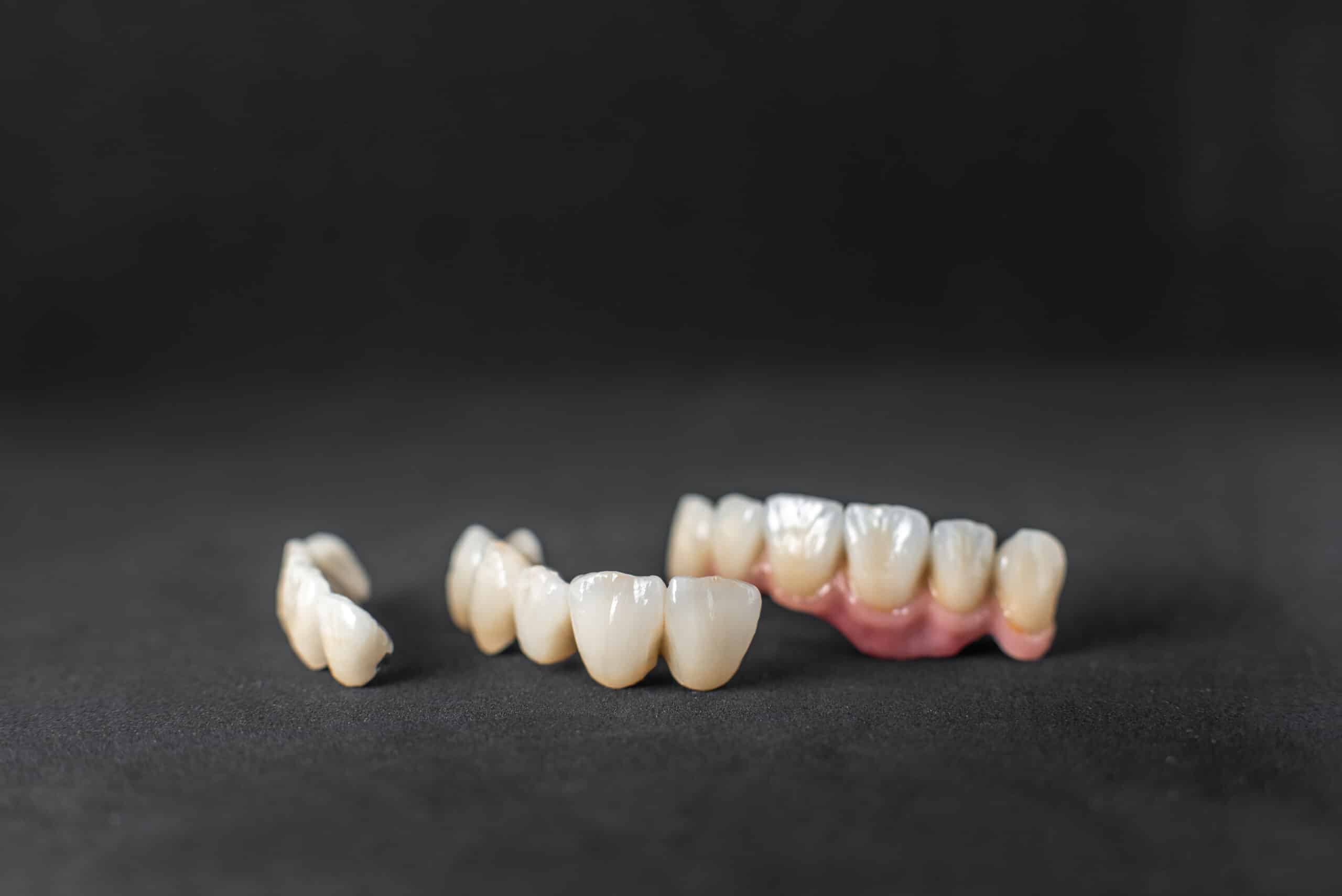 Porcelain Vs. Zirconia Crowns