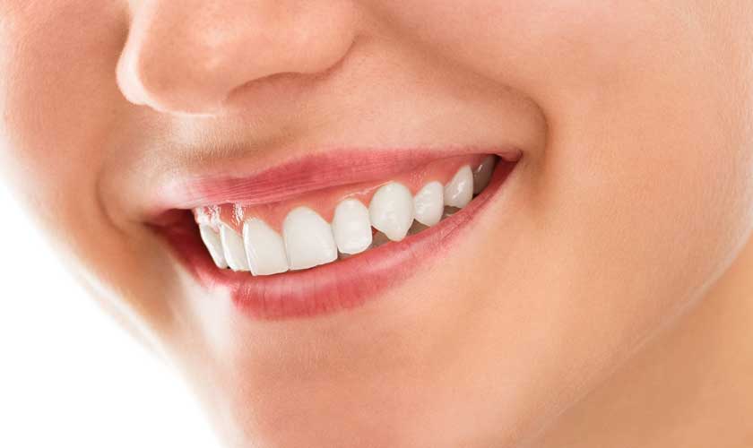 Teeth Whitening And The Benefits Associated With The Treatment