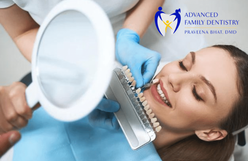 What should you know about dental veneers?