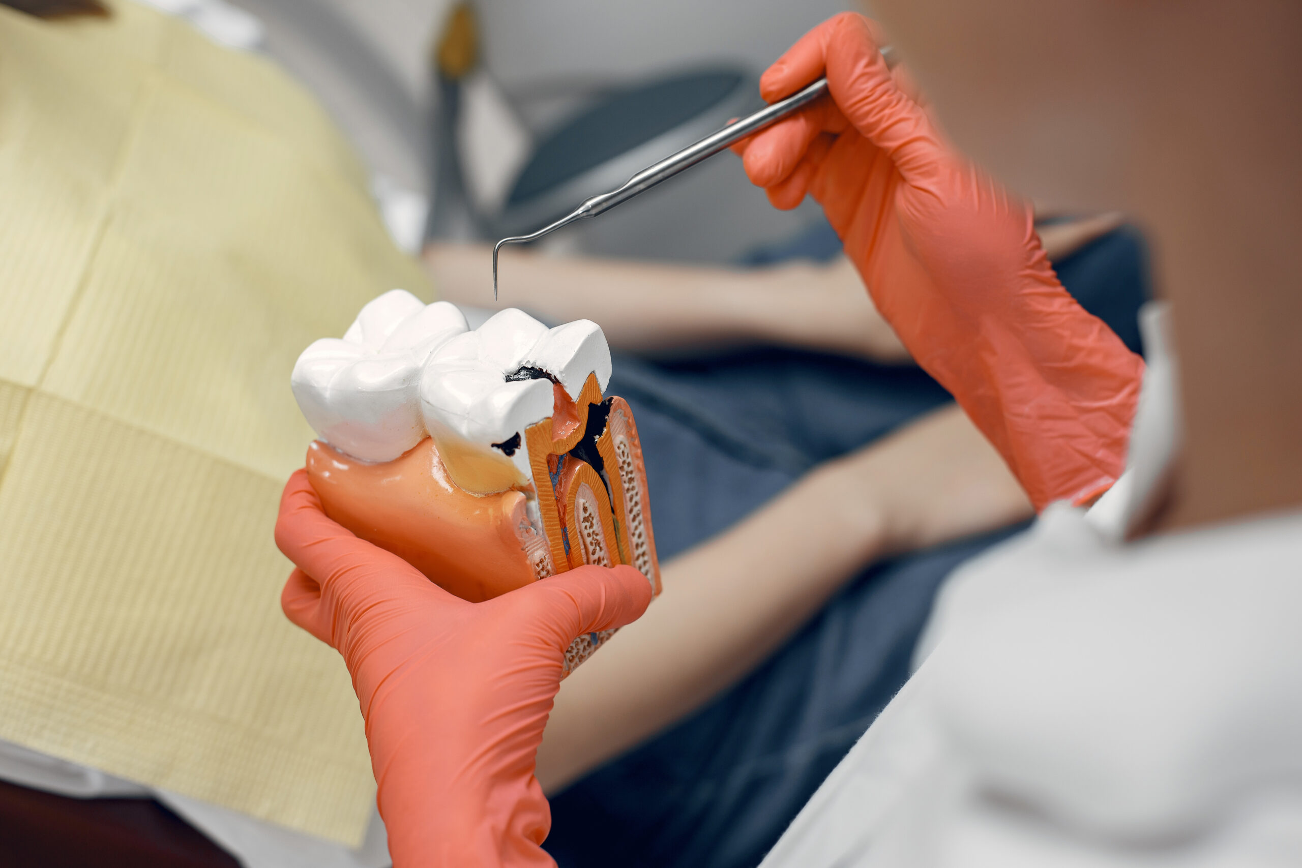Enigma Of Wisdom Tooth Extraction: What You Need To Know