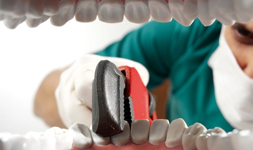 Can A Dentist Pull 6 Teeth At Once?