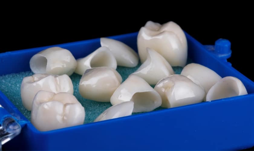 Types of Dental Crowns and Cost a comphrensive guide