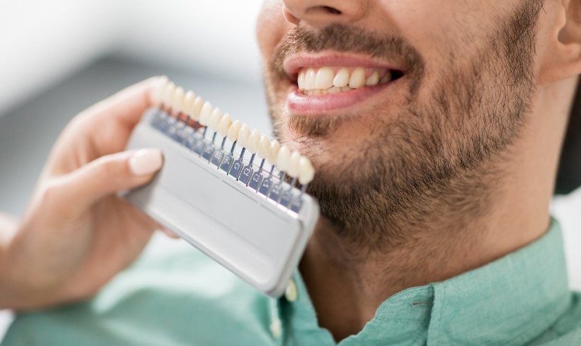 Illustration showing a teeth whitening treatment being applied to teeth with veneers, representing the potential risk of damage to the veneers from whitening agents.