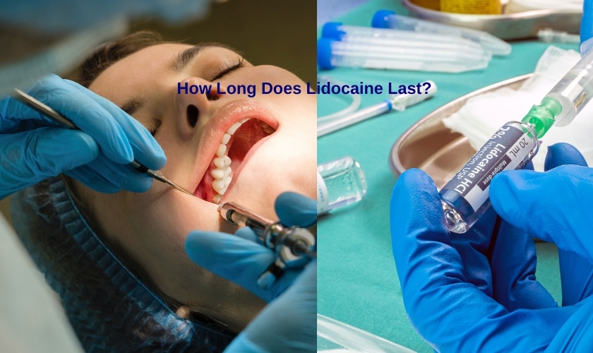 How Long Does Lidocaine Last?