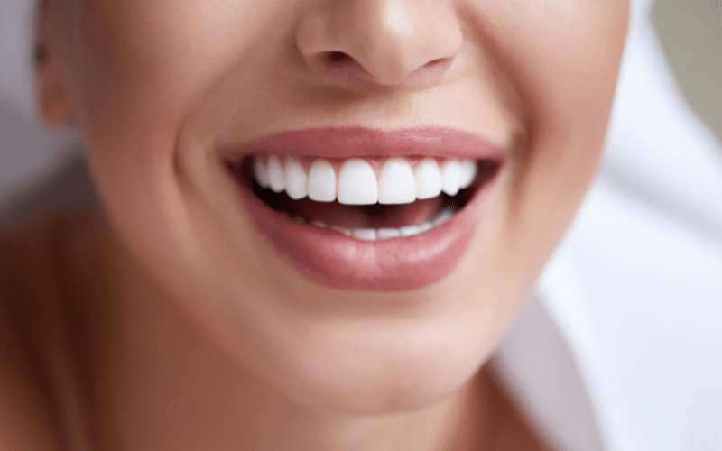 How To Get Amazing Results With Teeth Whitening at Your Local Dentist?