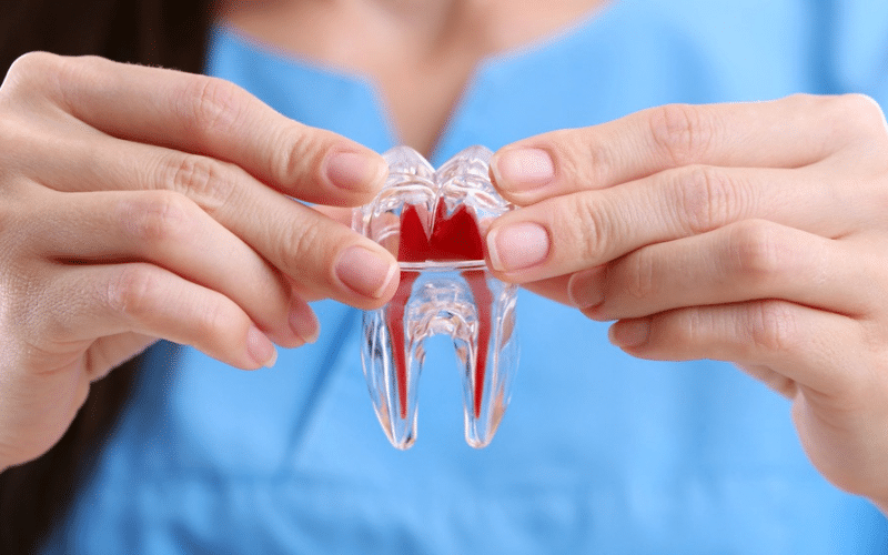 Root Canal Treatment Tips from Dentist
