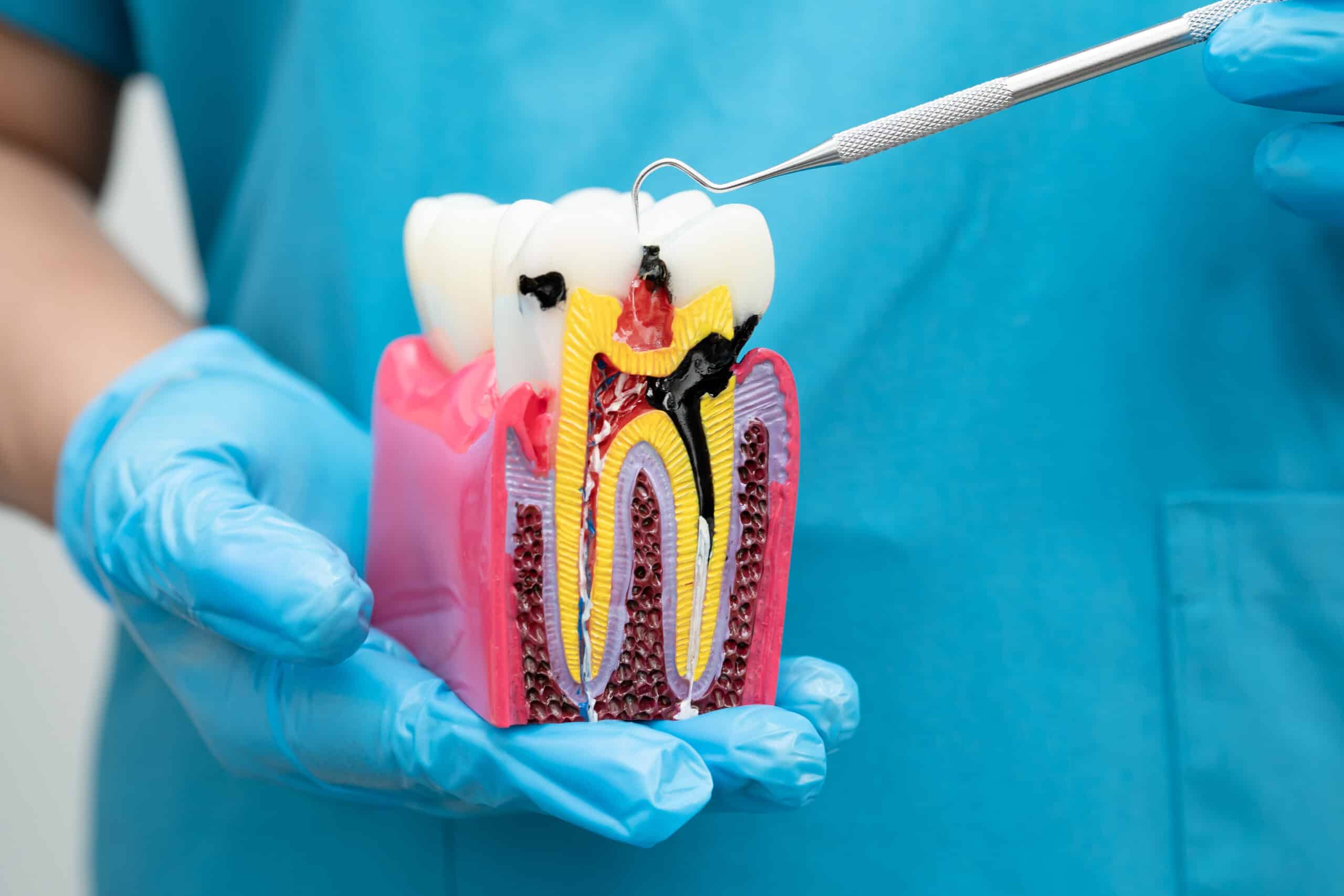 A dentist holding a root canal in Plant City FL