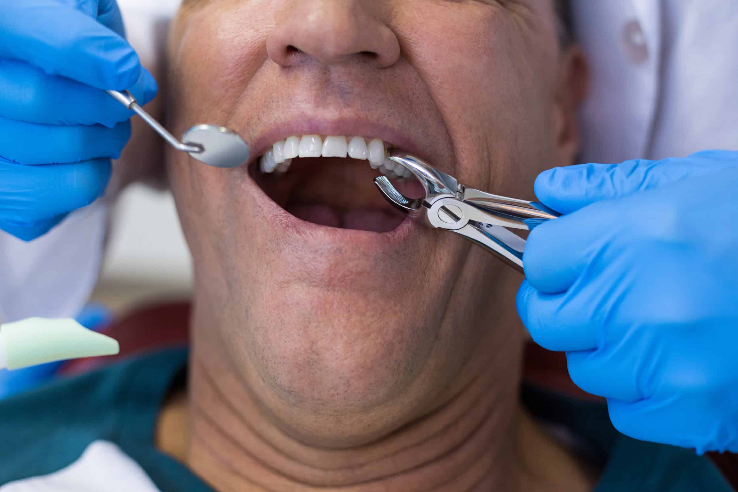 A dentist in Plant City extracts a man's teeth.