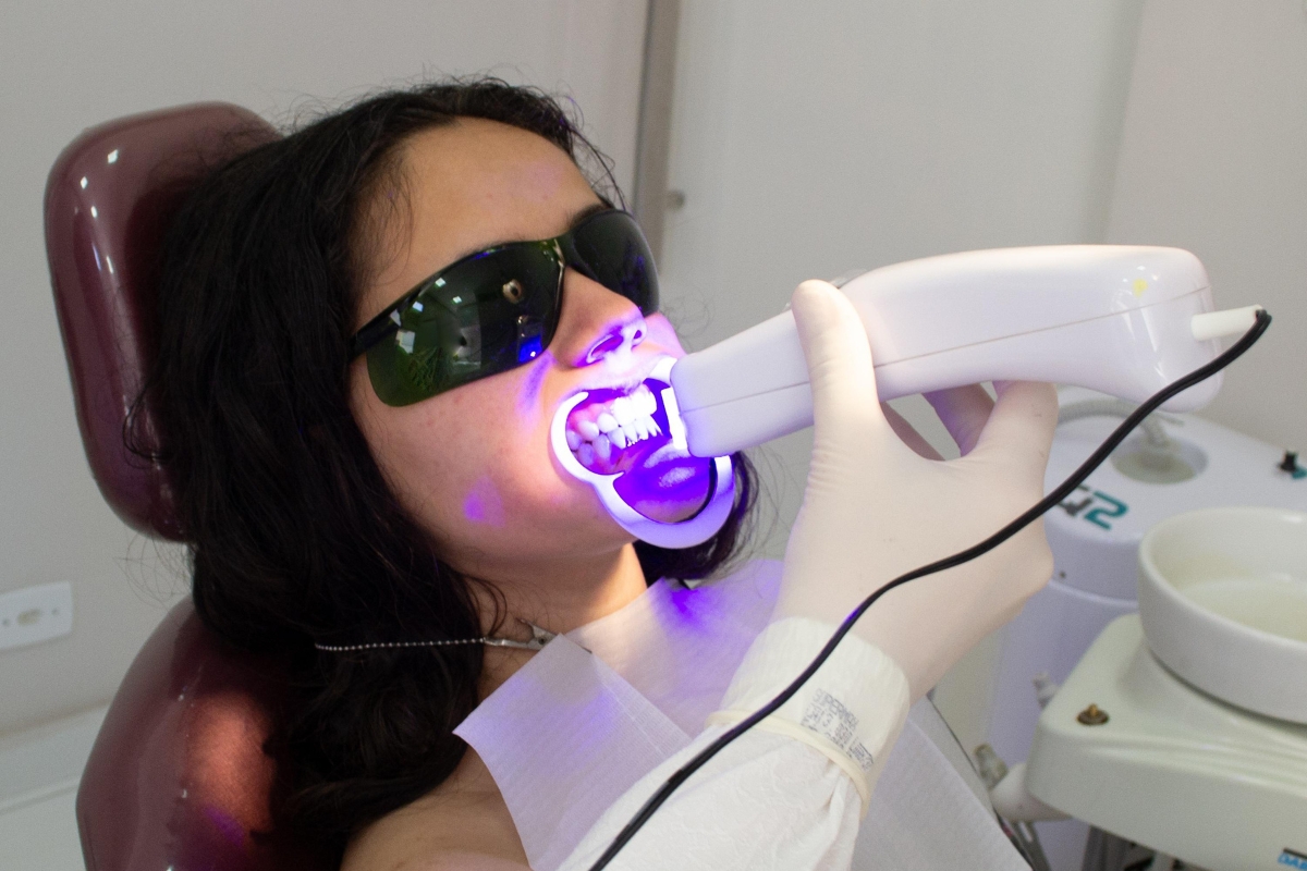 Teeth-Whitening-Fort-Worth