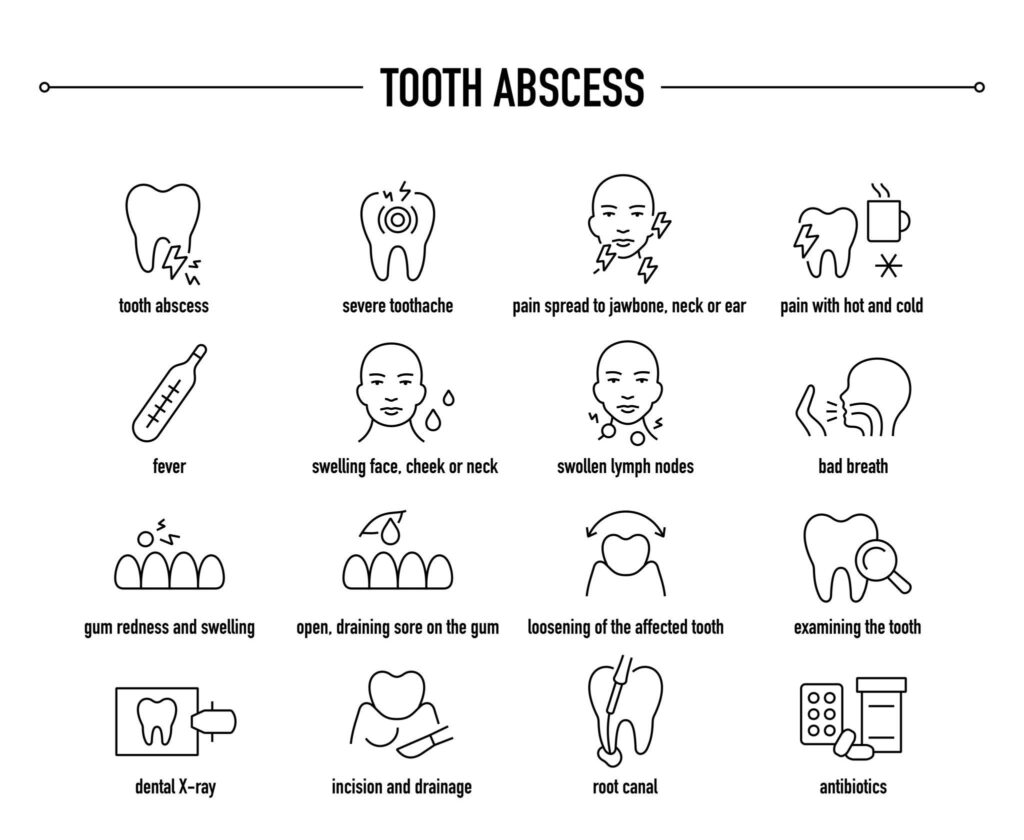 Dental illustration showing infected, cracked, and decayed teeth causing pain at night