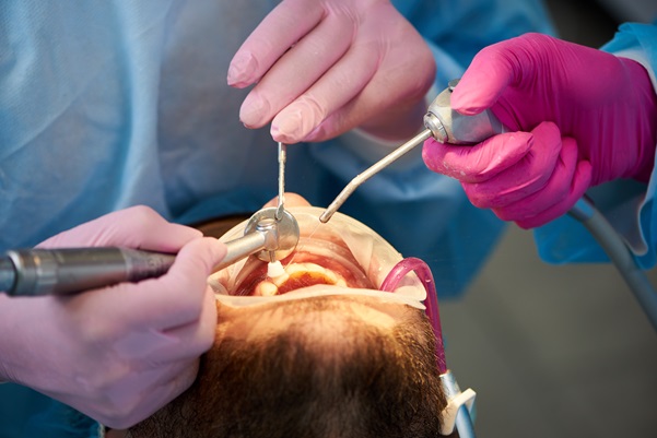 Root Canal Recovery Tips- How Patients Can Heal Quickly and Comfortably