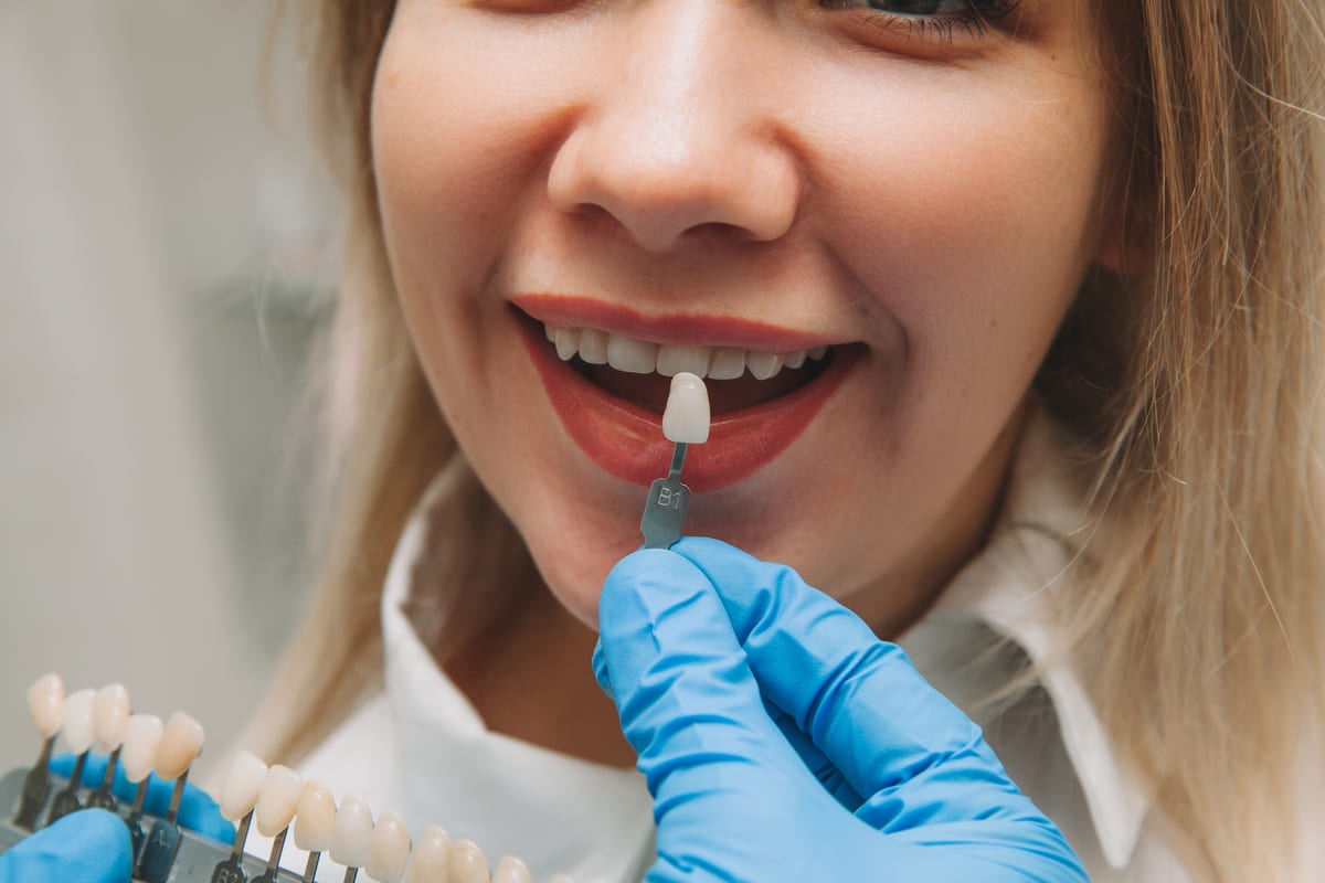 Veneers in Blue Mound