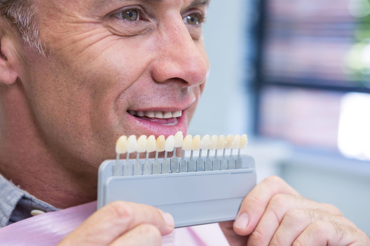 Veneers in Haslet