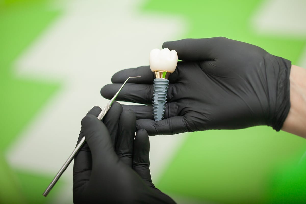 Dental Implants in Blue Mound