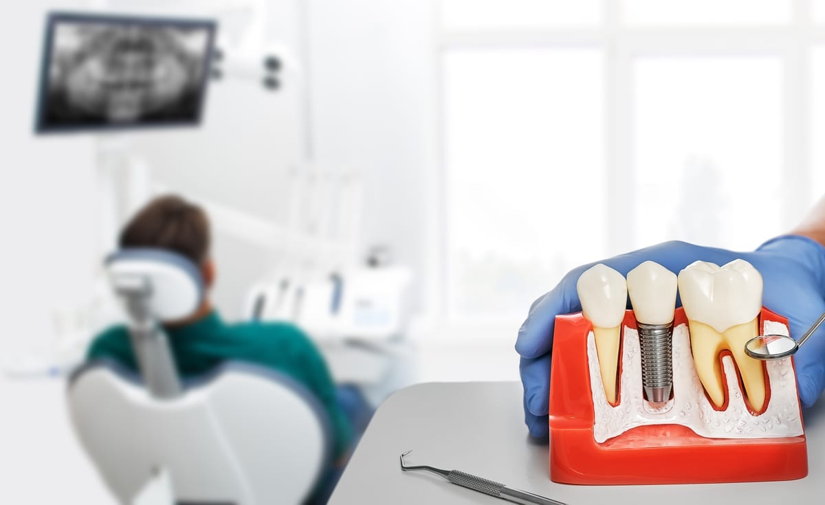 Dental Bridges in Fort Worth