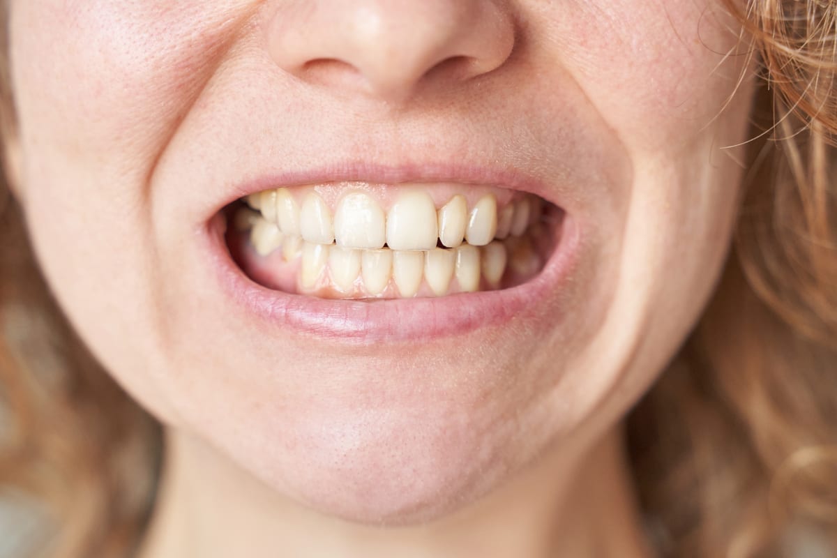 Gum Disease Treatment in Haltom City