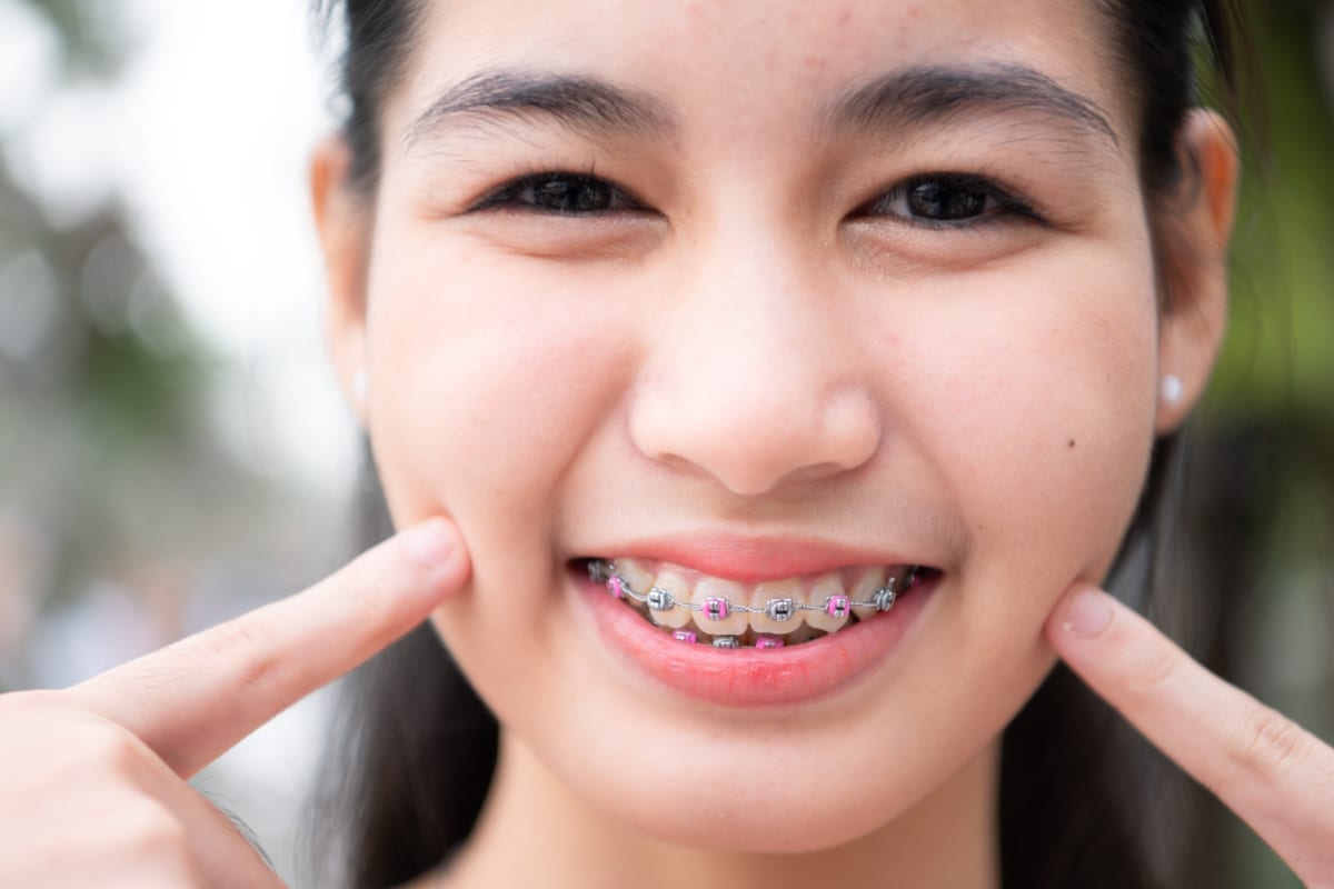 Orthodontics in Fort Worth