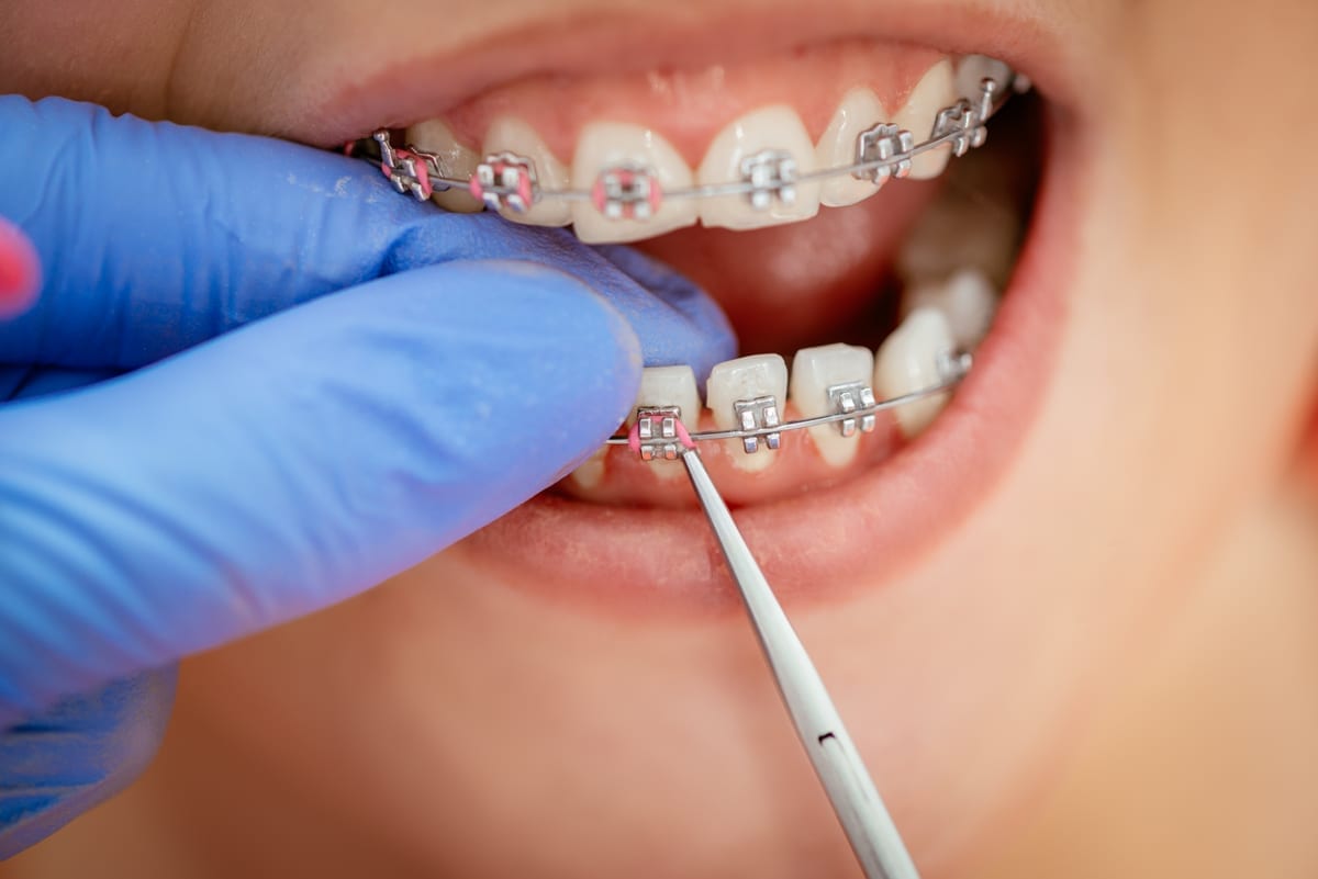 Restorative Dentistry in Haltom City
