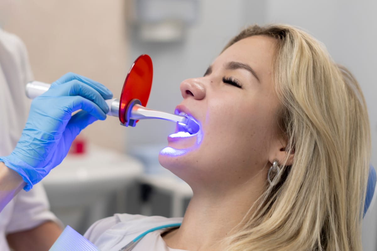 Teeth Whitening in Fort Worth