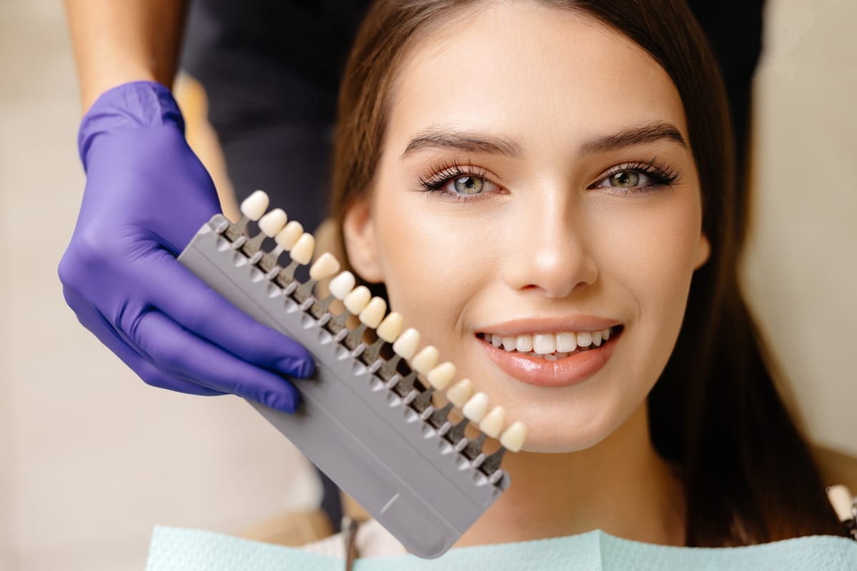 Veneers in Fort Worth