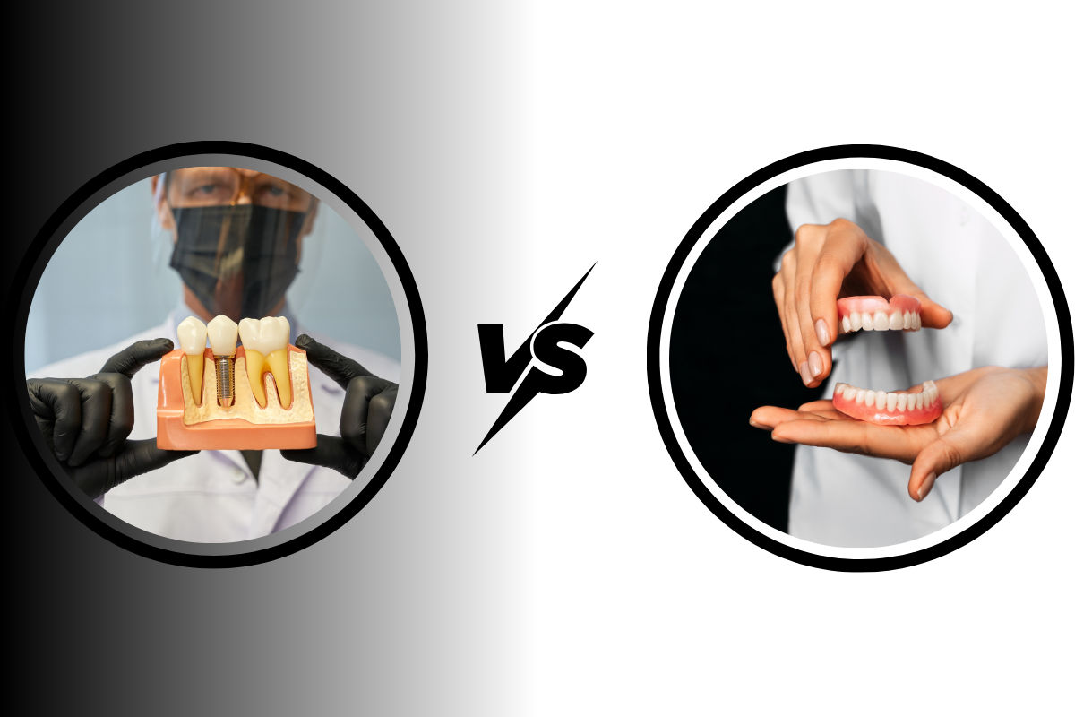 dental implants vs dentures