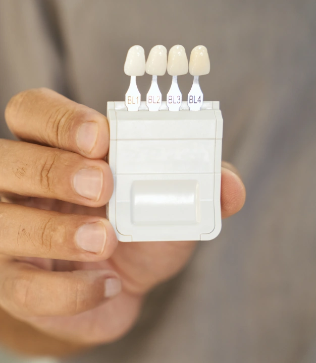 Dental veneer shade guide showing four tooth-colored porcelain veneer samples labeled BL1 through BL4.