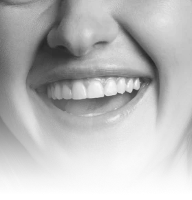 Woman with a bright, healthy white smile showing excellent dental results.