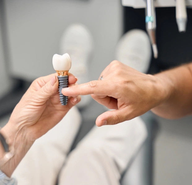 Dental Implants