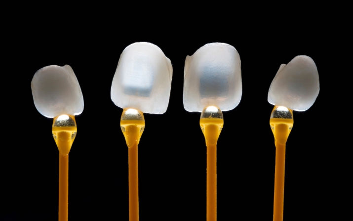 a comprehensive guide to getting dental veneers
