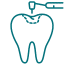 tooth-filling